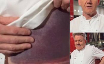 Gordon Ramsay shares important message after potentially fatal accident