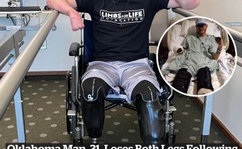 Oklahoma man, 31, loses both legs following frisbee injury that nearly cost him his life