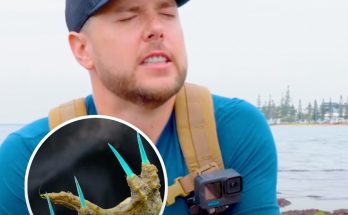 Man reveals what happens as he stings himself with 'most venomous fish in the world' Published 20:24 26 Nov 2024 GMT Man reveals what happens as he stings himself with 'most venomous fish in the world' Mark Vins stung himself on purpose to show viewers just how painful a sting from this fish can be Lucy Devine Lucy Devine A man has revealed the shocking consequences he suffered after he stung himself with venom from the 'most venomous fish in the world'. It's hard to imagine why anybody would ever want to purposely sting themselves with one of the most 'toxic' venoms known to man - but Mark Vins, host of YouTube channel, Brave Wilderness, did just that. Having already stung himself with some other dangerous fish - including the lionfish and the scorpionfish - Vins decided to take his investigations one step further and allow a stonefish to sting him. The stonefish is a master at camouflage (Getty Stock Photo) The stonefish is a master at camouflage (Getty Stock Photo) According to Ocean Conservancy, the stonefish is the 'most venomous fish' on the planet and can cause paralysis and in some cases, death. They are particularly dangerous due to their incredible camouflage. Blending in with their surroundings, the fish have a rocky appearance and are pretty docile within the water. This means swimmers and surfers are at particular risk of stepping on their razor sharp spikes, which are ready and loaded with deadly venom. Oceana explain: "They almost always sit perfectly still, on the sea floor, in their preferred habitat of coral and rocky reefs, and their colors are often a perfect match for the substrate. Some individuals have even been observed with algae growing on them. "While this camouflage gives them further protection from predators, its primary purpose is to allow stonefish to ambush their prey." In order to educate others on the dangers of the stonefish, Vins filmed himself being stung on camera - and it's pretty horrifying. Play In the video, Vins first sets about trying to find a stonefish, which he manages to locate hiding among some rocks on the sea bed. He first shows viewers how the stonefish manages to sting predators, revealing bright blue spikes hiding along its spine. He then takes a piece of neoprene to demonstrate just how much venom is released during each sting. Admitting he was feeling increasingly nervous about subjecting himself, Vins explained that he had taken a number of measures just in case he had a serious reaction to the venom. "While the venom is extremely potent it is thermolabile, so if treated properly and with medical attention, you will survive the sting of a stonefish," he explained. Thermolabile essentially means the venom is destroyed by heat. "I have brought the antidote with me, a thermos filled with hot water that's around 140°F, a compress to hold over the wound and if I do go into a state of anaphylaxis shock I always carry with me an epi pen." he continued. Vins also added that he was only a three-minute drive from an emergency department, should he need medical attention. Vins was in intense pain (Brave Wilderness/YouTube) Vins was in intense pain (Brave Wilderness/YouTube) Explaining it would probably be the 'worst sting' he would ever endure, Vins went ahead and sunk his hand into one of the creature's spikes. Within seconds, Vins was keeling over in agonising pain, describing it as 'immediate fire' which spread throughout his fingers. "It's a different magnitude of pain," he said. As the venom spread up his hand, Vins could be seen applying the hot water, but the pain carried on traveling up his arm and into his neck. Vins explained even a month after the sting, he still experiences numbness and tingles. Man reveals what happens as he stings himself with 'most venomous fish in the world'