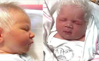 Baby boy born with snow-white hair dubbed Prince Charming