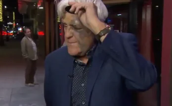 People Are Seriously Suspicious Of Jay Leno’s Injuries: Broken Wrist, Beaten Up Face And Missing Fingernail