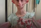 TikTok star Beandri Booysen dies at 19 from rare aging disease