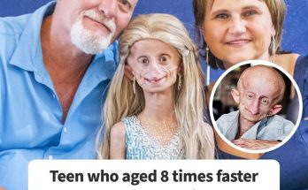 Teen Who Aged 8 Times Faster And Dreamed Of Marrying Passes Away Before Christmas