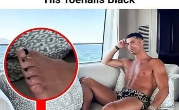 Cristiano Ronaldo painted his toenails black because…