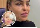 “So Cowardly”: Katie Piper Announces ‘End Of The Road’ Health Update 16 Years After Acid Attack