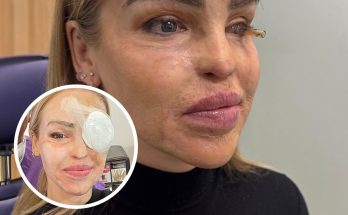 “So Cowardly”: Katie Piper Announces ‘End Of The Road’ Health Update 16 Years After Acid Attack