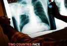 Kansas Tuberculosis Outbreak, Largest in US History, Hits 67 Active Cases Across Two Counties – Latest Details