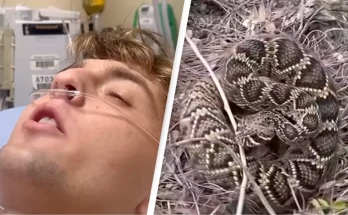 Terrifying moment influencer livestreams himself being bitten by snake and admitted to ICU