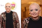 Linda Nolan dies aged 65 after 20-year breast cancer journey