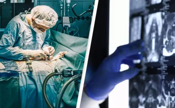 Doctor 'catches' cancer from patient while he was performing surgery in unbelievably rare case